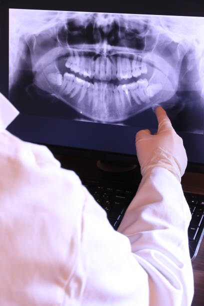 Best Emergency Wisdom Teeth Removal in Valley Hill, NC